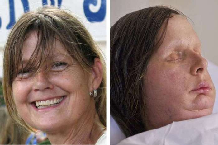 <H2>Transplantace obličeje</H2><P>První částečná transplantce obličeje proběhla ve Francii v Amiensu v roce 2005. O pět let později lékaři ve Španělsku provedli první celkovou transplantaci tváře. Velkým milníkem se pak staly transplantace obličeje, které v nemocnici v Bostonu v Massachusetts provádí původně český lékař <B>Bohdan Pomahač</B>. Uskutečnil i první úplnou transplantaci obličeje ve Spojených státech, která byla zároveň teprve třetí na celém světě. Nyní se chystá na transplantace nohou. </P>